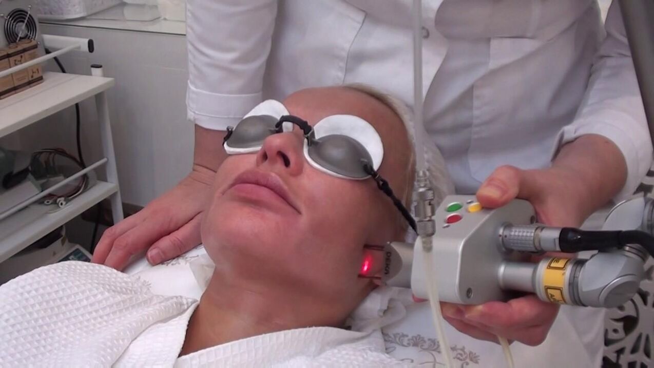 Perawatan dengan sinar laser pada area bermasalah pada kulit wajah