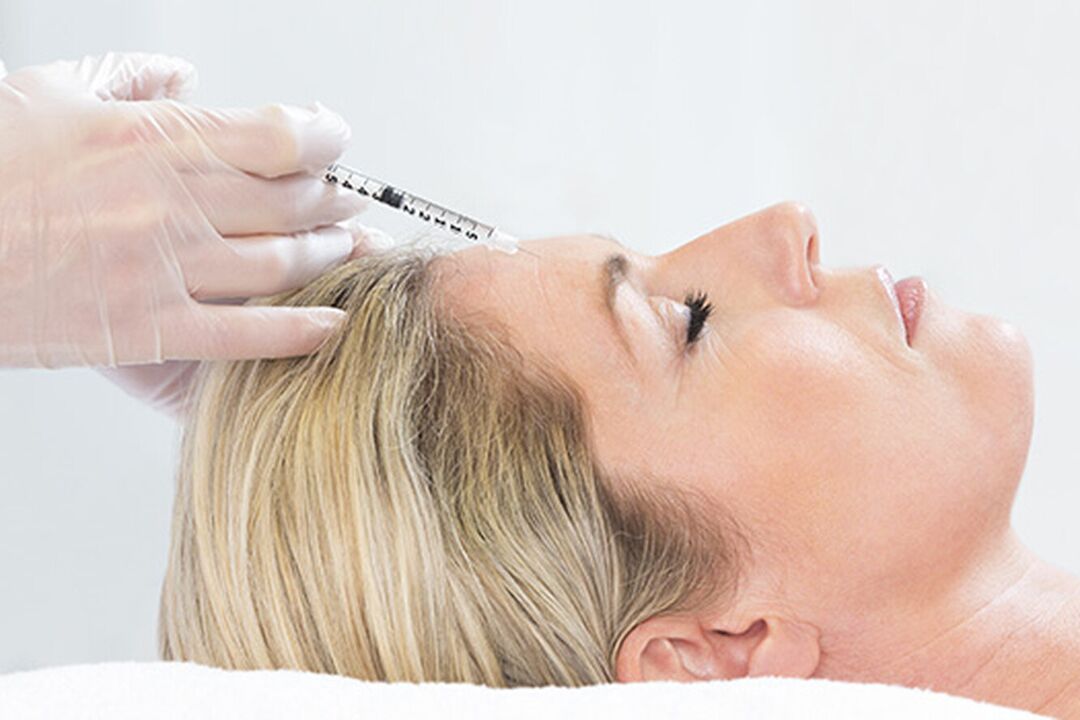 Plasmolifting adalah metode injeksi peremajaan kulit wajah